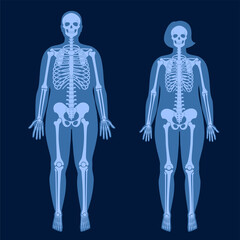 Poster - Skeleton x ray