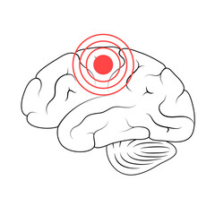 Sticker - Pain Brain Illustration