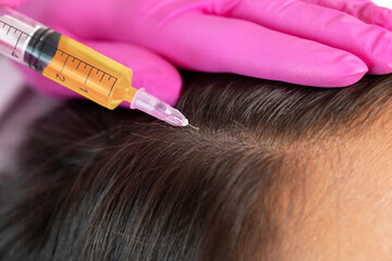 cosmetologist does prp therapy against hair loss and anti-dandruff of a beautiful woman in a beauty 