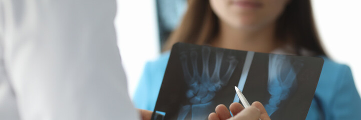 Wall Mural - Close-up of doctor hands holding skiagram. Surgeon talking about wrist trauma. Smiling intern listening carefully to traumatologist. Traumatology and health care concept