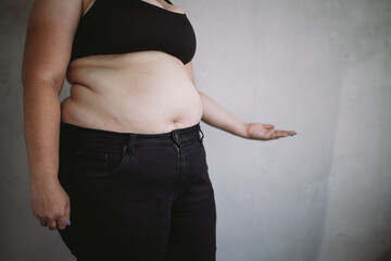 Wall Mural - Overweight woman with obese body over studio background, copy space. Weight loss concept