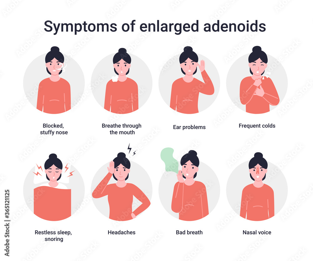 Set icons symptoms of enlarged adenoids. Medical infographic. Flat ...