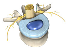 Lumbar Vertebra With Intervertebral Disc, Medically 3D Illustration