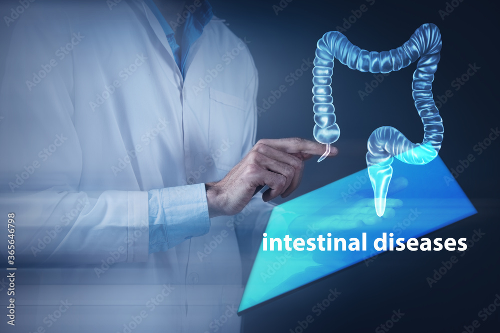 Normal Intestines Ir radiographs of human intestines holographic scan projection 3D ...