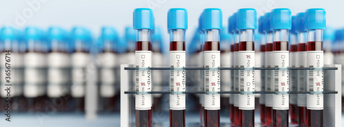 Coronavirus Covid19 test tubes in a rack. Medical screening and Covid tests production