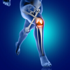 Poster - 3D male medical figure running with knee bone highlighted