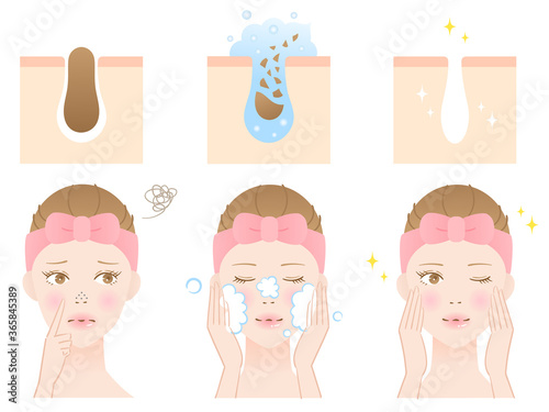 鼻の黒ずみ除去 洗顔 断面図 Stock Vector Adobe Stock 鼻の黒ずみ除去 洗顔 断面図 Stock Vector Adobe Stock