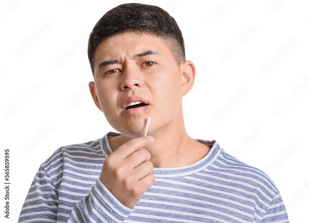 Asian man with cold sore applying ointment on his lips against white background
