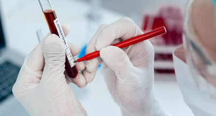 Wall Mural - close up. scientist puts a mark on the tube with the test.