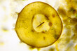 Microscopic view of testate amoeba (Centropyxis aculeata) shell. Brightfield illumination.