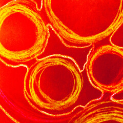 Cancer Cells Transparent. Bloodstream Round