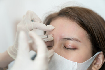 Wall Mural - Hands of beautician injecting botulinum in female forehead. Woman closed her eyes and wearing face mask.