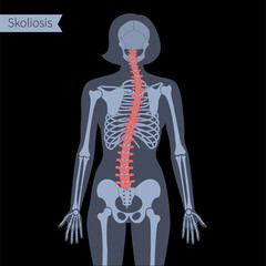 Poster - Spine X ray