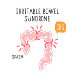 Fototapeta Pokój dzieciecy - Irritable bowel syndrome.
Illustration of a spasm on the gut.
Vector illustration of medical posters 
in gastroenterology
