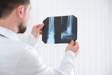 Sticker - Professional orthopedist examining X-ray picture in his office, focus on hands