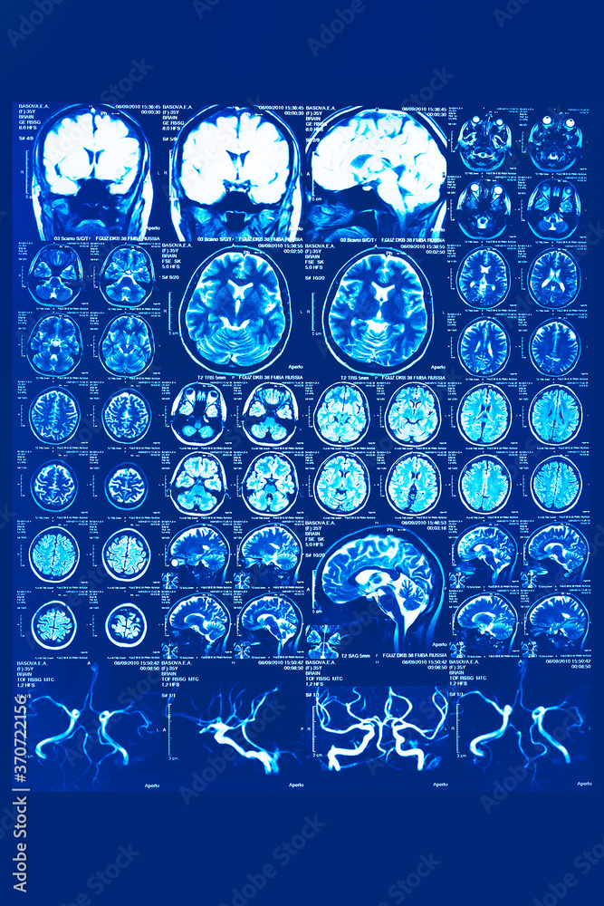 Computer tomography image of human brain regions. MRI scan Stock ...