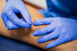 © Jesus Diaz/ADDICTIVE STOCK - From above of crop faceless sports medicine doctor in sterile gloves inserting thin needle in leg of unrecognizable male patient in underwear lying on examination couch during acupuncture process