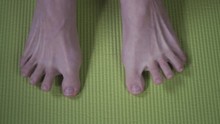 Toe Spreading As A Foot Exercise