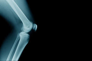 Canvas Print - lateral view of human knee joint