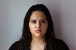 © Hugo - Hispanic white woman with acne, imperfections and pimples on a white background. White teenager with black eyes and black hair