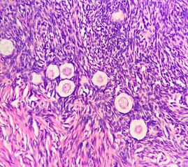 Poster - Photo of normal ovary, showing ovarian stroma, primordial follicles and oocytes, photo under microscope, magnification 400x