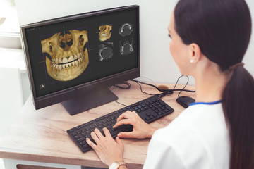 Dental 3D tomography, female dentist at office