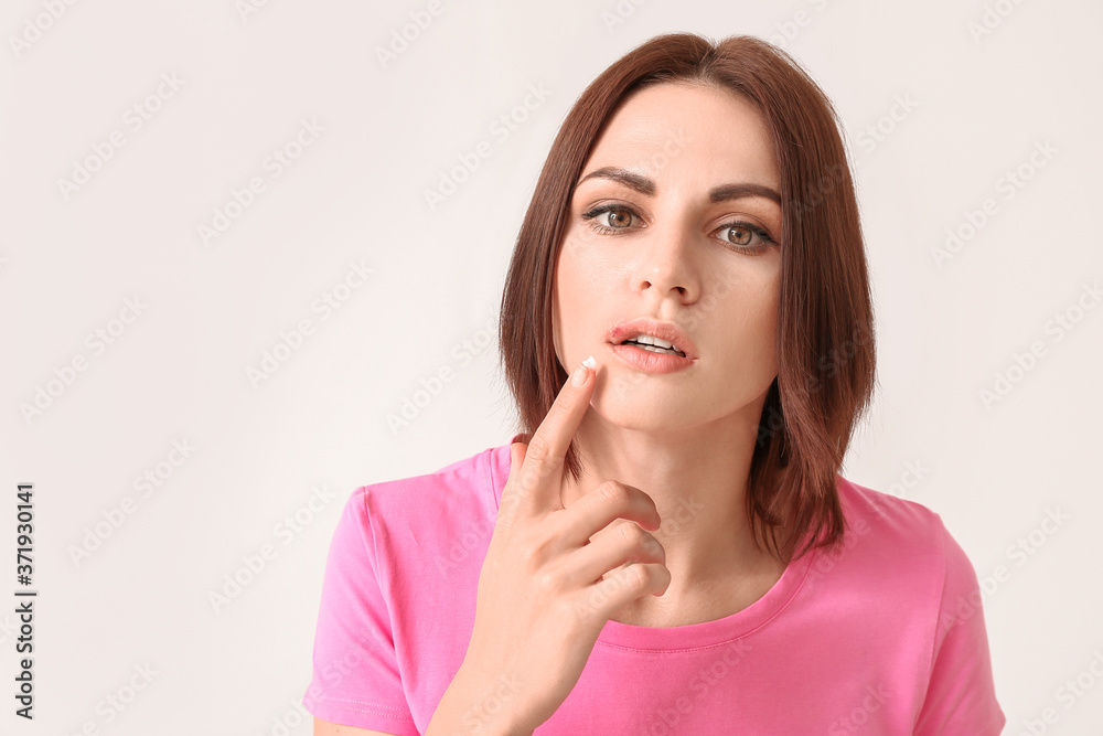 Young woman with cold sore applying ointment on her lips against light background