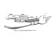 Marey's Sphygmograph Applied To Arm In The Old Book Human Phisiology By H. Chapman, Philadelphia, 1887