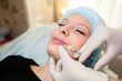 © fotofrol - Cosmetic procedures, injections for the face.