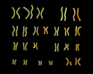 Wall Mural - Karyotype of Angelman syndrome