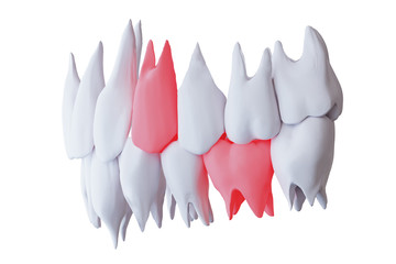 Wall Mural - human teeth with a sore tooth, red lower sixth and upper fourth molar teeth, isolated on white, side view, 3d render