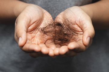 woman slicking hair falling out in two hand after facing hair loss problem of maintenance losing by sad strain cancer patients after receiving chemotherapy. Health care and medical concept.