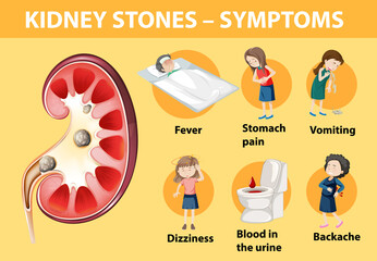 Canvas Print - Kidney stones symptoms cartoon style infographic