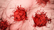 Skin cancer cells