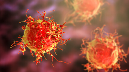 Poster - Skin cancer cells