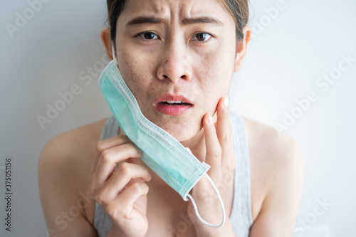 Fotomural Asian woman worry about acne occur on her face after wearing mask for long time during covid-19 pandemic