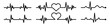 Heart icon in linear design isolated vector signs, medical health care, love passion concept, heart shape, romantic