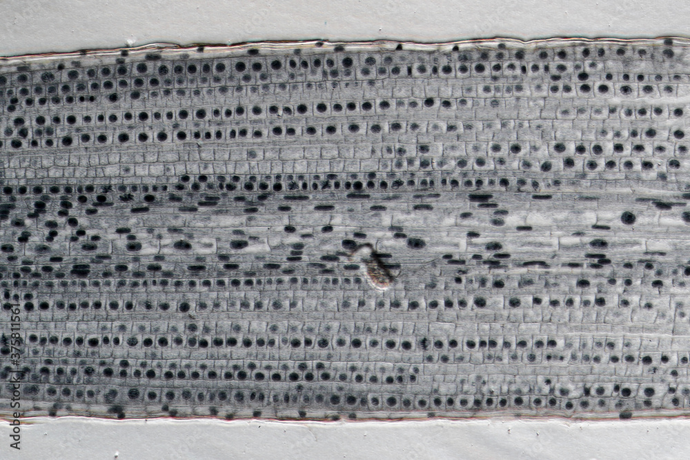 Typical plant cell of root tip, micrograph Stock Photo | Adobe Stock