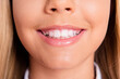 © deagreez - Close up cropped photo of charming lovely schoolgirl little lady mouth pink balm shiny toothy white smile teeth hygiene dentist clinic promo healthy oral care disease prevention concept