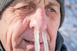 Portrait of an elderly man with icicles in his nose. The man's snot was frozen in his nose. Runny nose in the winter forest. Frosty weather in winter. Comic concept of a winter cold.