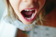 © Maria Manco/Stocksy - closeup of little kid with extra teeth in mouth