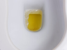 Closeup Urine Or Pee In The Toilet Bowl