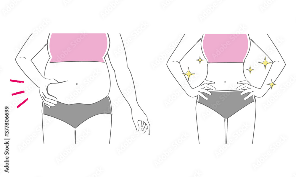 ダイエットをした女性の腹部 ビフォーアフター 線画 Wall Mural Fuwari ダイエットをした女性の腹部 ビフォーアフター 線画 Wall Mural Fuwari