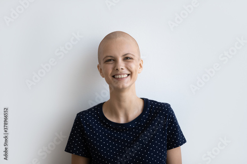 Fotografía Profile picture of smiling young hairless sick woman struggle fight with oncology isolated on grey studio background