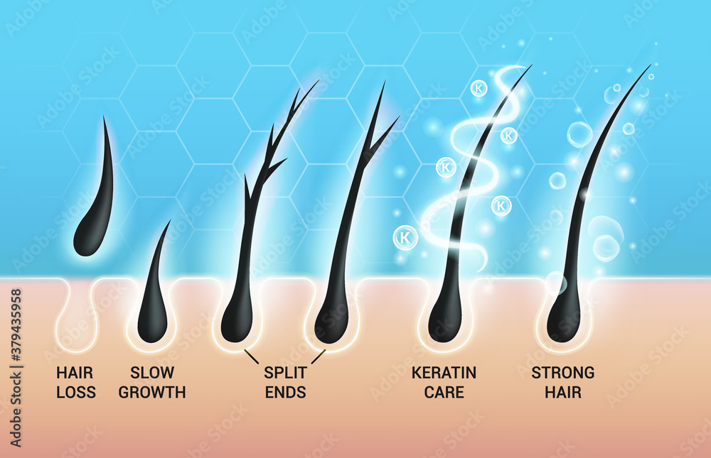 Different hair problems and deep salon treatment vector illustrations ...