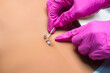 Belly button piercing. The beautician does the piercing procedure.