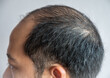 Cropped shot view of Asian men head with few grey hair growing. Hair turns white when the pigmentation cells responsible for colour (melanin) stop being produced.