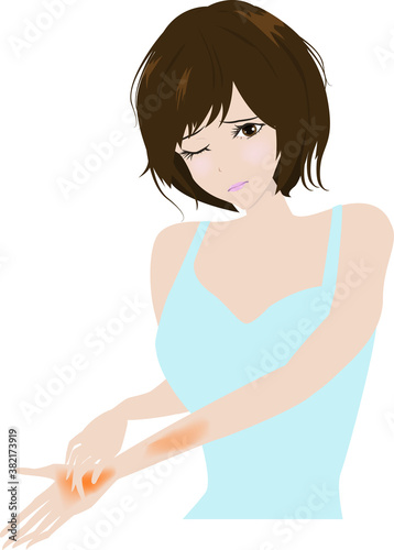 手と腕が乾燥して痒くてたまらない綺麗な女性のイラスト Vecteur Stock Adobe Stock