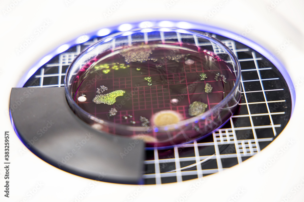 Bacteria Escherichia coli (E. coli) culture in petri dish with macconkey agar for check on colony counter. Bacterium culture growth in glassware. Medical tests in laboratory.