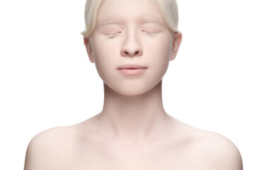 Innocent. Portrait of beautiful albino woman isolated on white studio background. Beauty, fashion, skincare, cosmetics concept. Copyspace. Well-kept skin, fresh look. Inclusion and diversity.